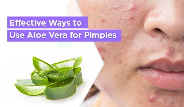 Effective Ways to Use Aloe Vera for Pimples