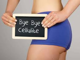 Top 5 Home Remedies To Get Rid Of Cellulite 