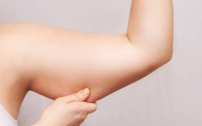 4 Best Arm Fat Reasons, Solutions & More