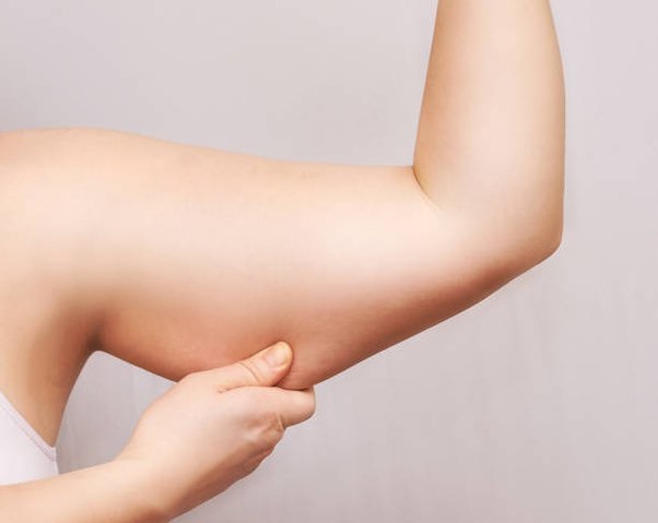 4 Best Arm Fat Reasons, Solutions & More